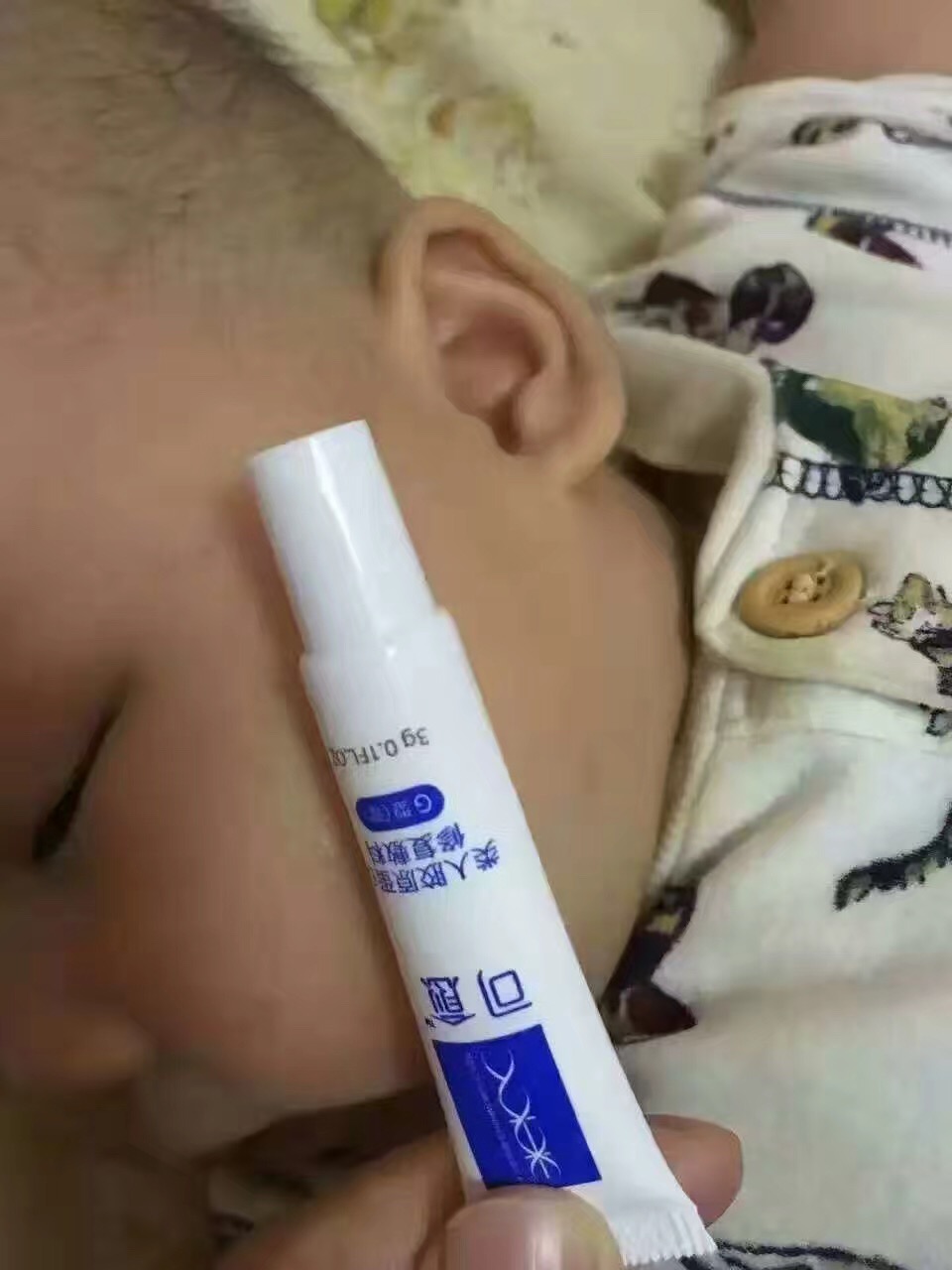 小宝宝湿疹，用可愈棒棒哒，医用级安全有效！良心产品！