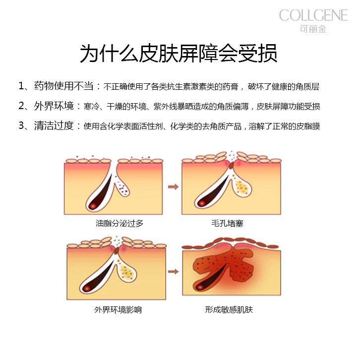 我为什么给你推荐可丽金？ 1.无激素、无香精、无色素、无铅汞、无酒精、温和不刺激！ 2.富含类人胶原蛋白，比动物胶原蛋白更安全！ 3.无病毒隐患、低排异反应、变性温度高达72℃以上！ 4.酸碱度为中性，不会破坏皮肤酸碱度！ 5.补水保湿，补充胶原及弹性蛋白，延缓衰老！ 6.引导和促进细胞生长，修复肌肤屏障！