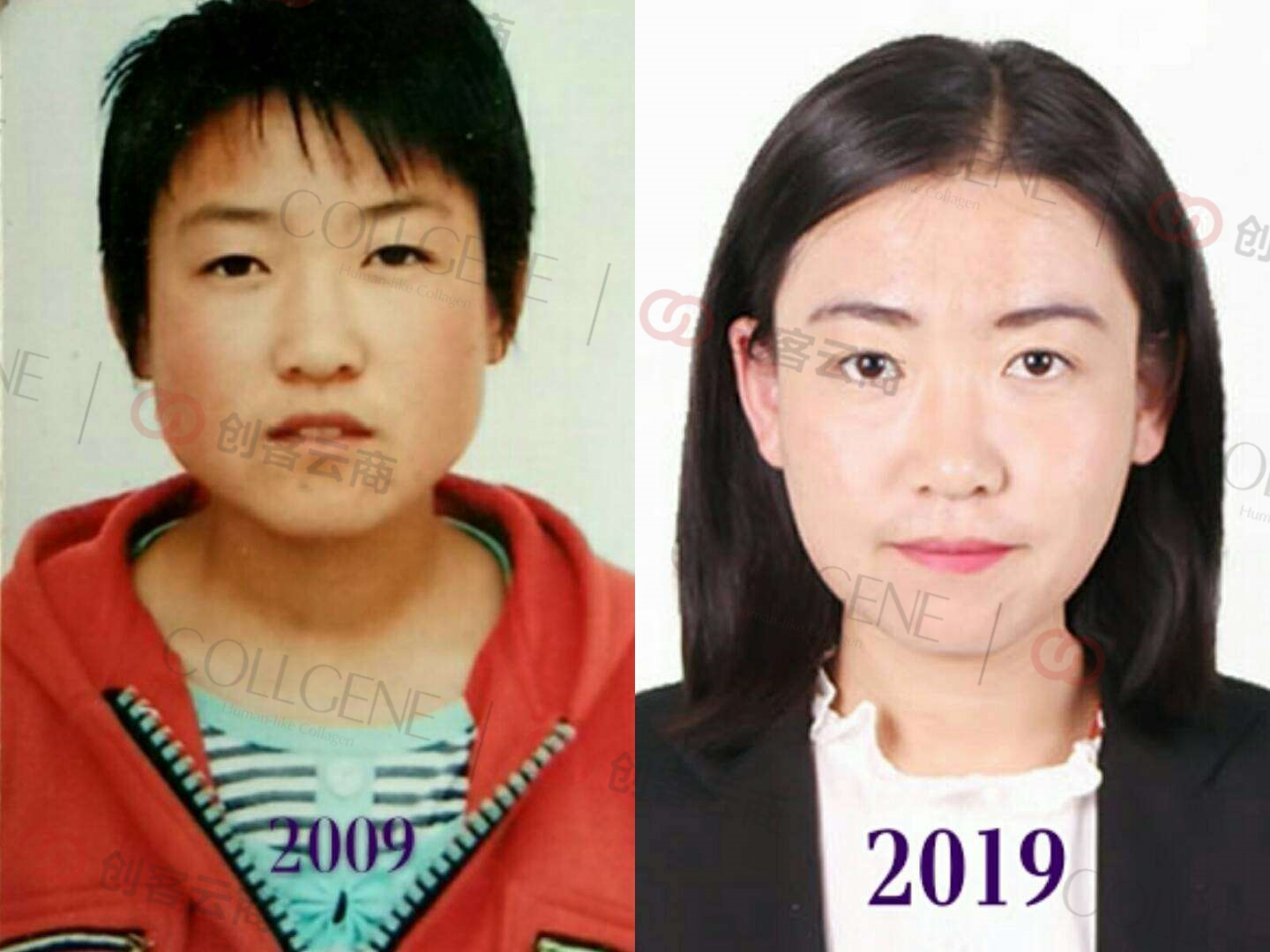 #晒晒你的十年对比挑战# 有一些人,十年间宛若冻龄 还有些人,甚至在这十年间“逆龄生长” 你对护肤的态度,就是对生活的态度。 愿你能遵从本心,勇敢的追求美 #可丽金# #创客云商# #类人胶原蛋白# #小魔女皮肤管理中心#